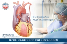 Սրտի անոթների շունտավորում