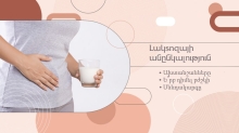 Լակտոզայի անընկալություն