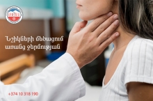 Նշիկների մեծացում առանց ջերմության