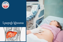 Լյարդի կիստա